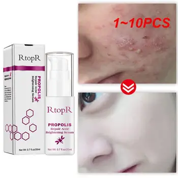 1 ~ 10DBS Propolisz akne eltávolítás arc szérum hidratáló tápláló halványít arcbőrt feszesítő bőr zsugorodó pórusok kozmetikumok