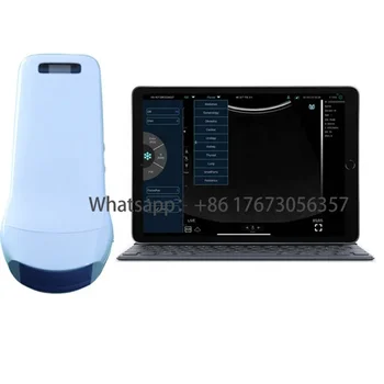 ultrassom portatil doppler 3d ultrassom sem fio ultrassom szonda vezeték nélküli 3 em 1